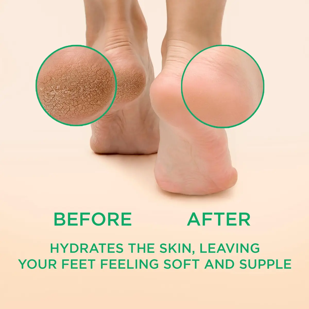 Lee Beauty Professional Peppermint Callus Remover Gel 2x6oz (12oz Total) | Smoother, Softer Feet in Minutes - view 2