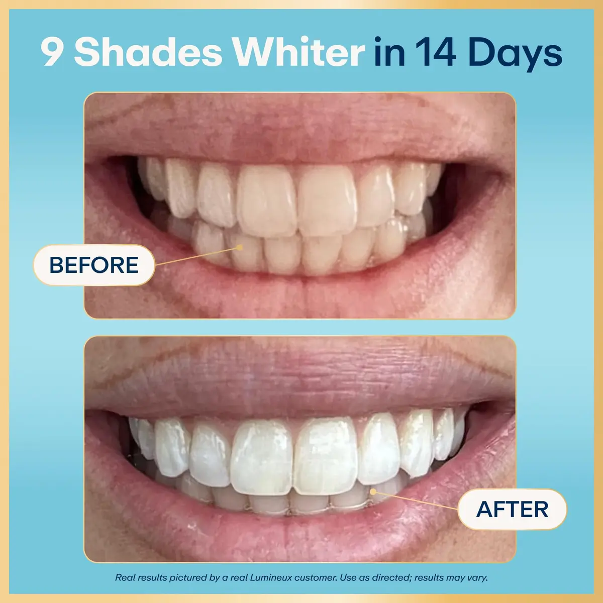 Lumineux Whitening Starter Set 7 Strip Treatments & 2 Pack Toothpaste | Peroxide-Free Enamel-Safe Whitening - view 2