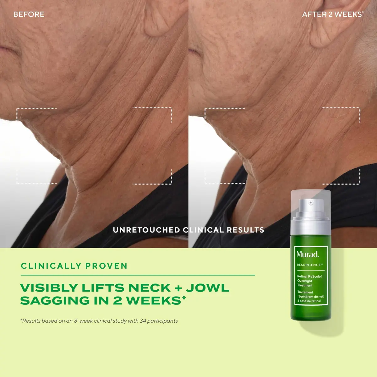 Murad Retinal Trial Kit - Encapsulated Retinal - 2-pc Set | Anti-Aging for Lines & Wrinkles - view 3