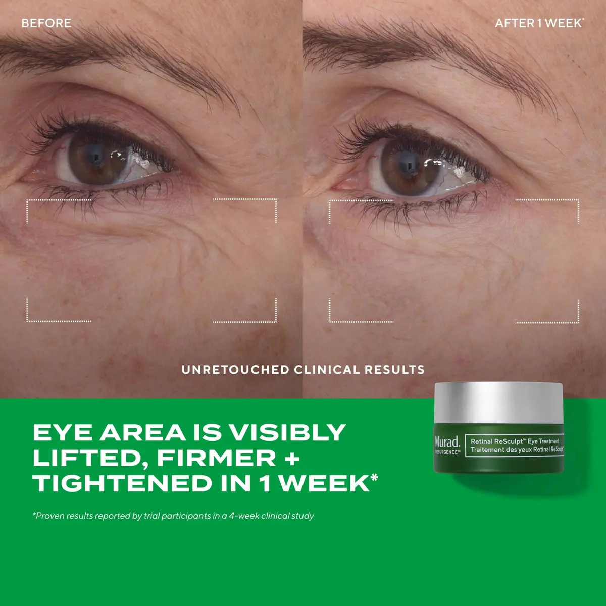 Murad Retinal Trial Kit - Encapsulated Retinal - 2-pc Set | Anti-Aging for Lines & Wrinkles - view 4
