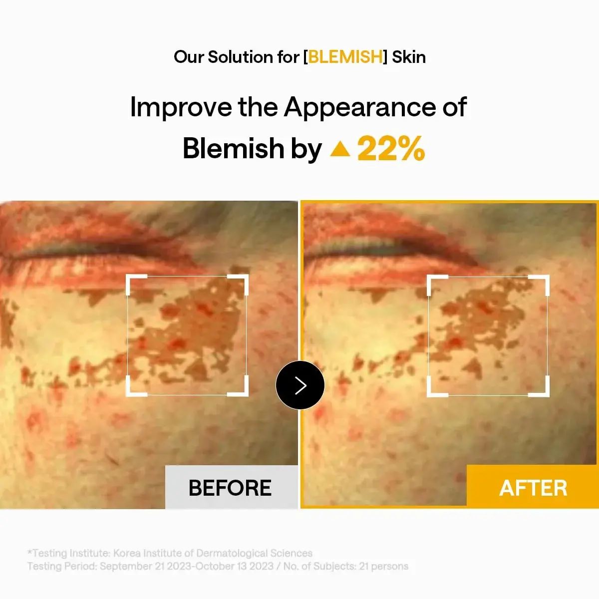 MEDIHEAL Vitamin & Collagen Under Eye Patches 60 Count | Targets Wrinkles, Dark Spots & Blemishes - view 5