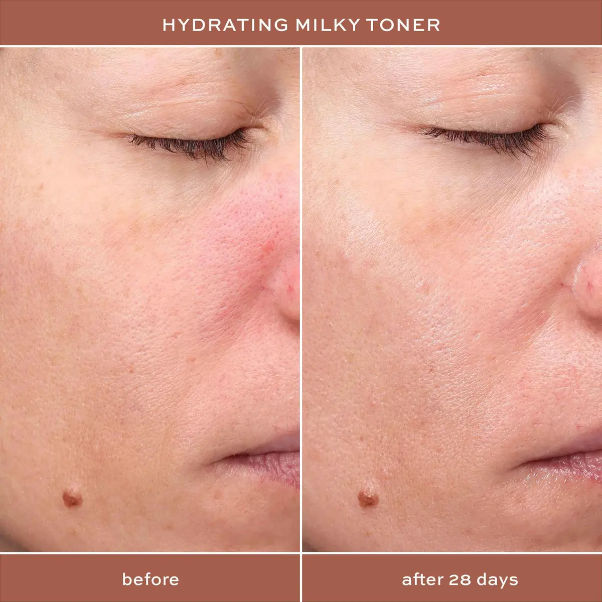 I.T.K. Glowy Skin 3-Step Routine - Hyaluronic Acid + Niacinamide Serum, Squalane Toner, Deep Moisture Ceramide Face Cream | Hydrating & Radiant - view 6