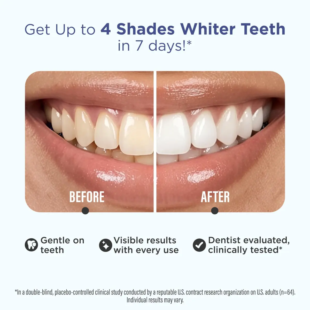 GuruNanda Teeth Whitening Strips Kit 32 Count (Pack of 1) | Hydrogen Peroxide & Coconut Oil for Brighter Smile - view 2