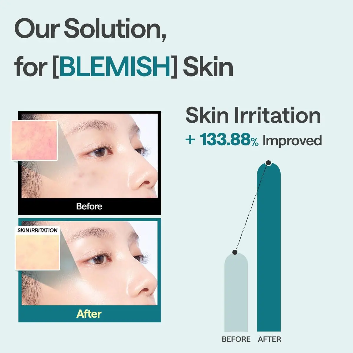 MEDIHEAL Madecassoside Essential Face Sheet Mask 24ml (0.811 Fl Oz) | Calms Redness & Evens Skin Tone - view 5