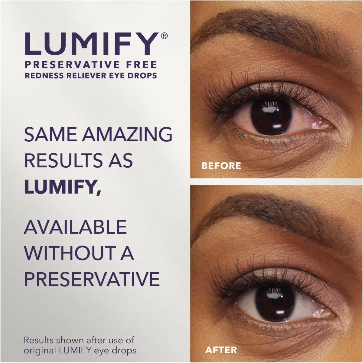 LUMIFY Preservative Free Eye Drops Redness Relief, Sensitive Eyes, 20 Single-Use Vials | Gentle & Effective Redness Relief - view 2