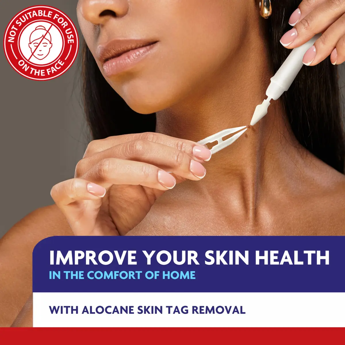 Alocane Skin Tag Removal Kit with 12 Precision Applicators | FDA-Cleared Cryotherapy for Safe Home Use - view 2