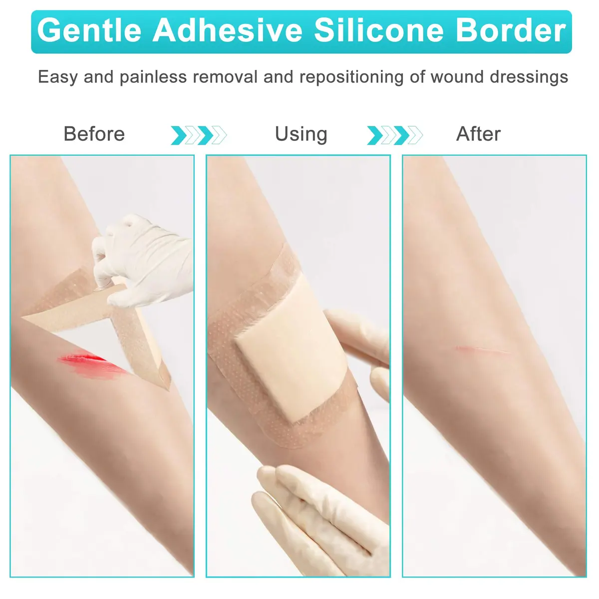 CAKRNPS Silicone Foam Dressing 4" x 4" | Waterproof, Absorbent, Self Adhesive for Wounds - view 8