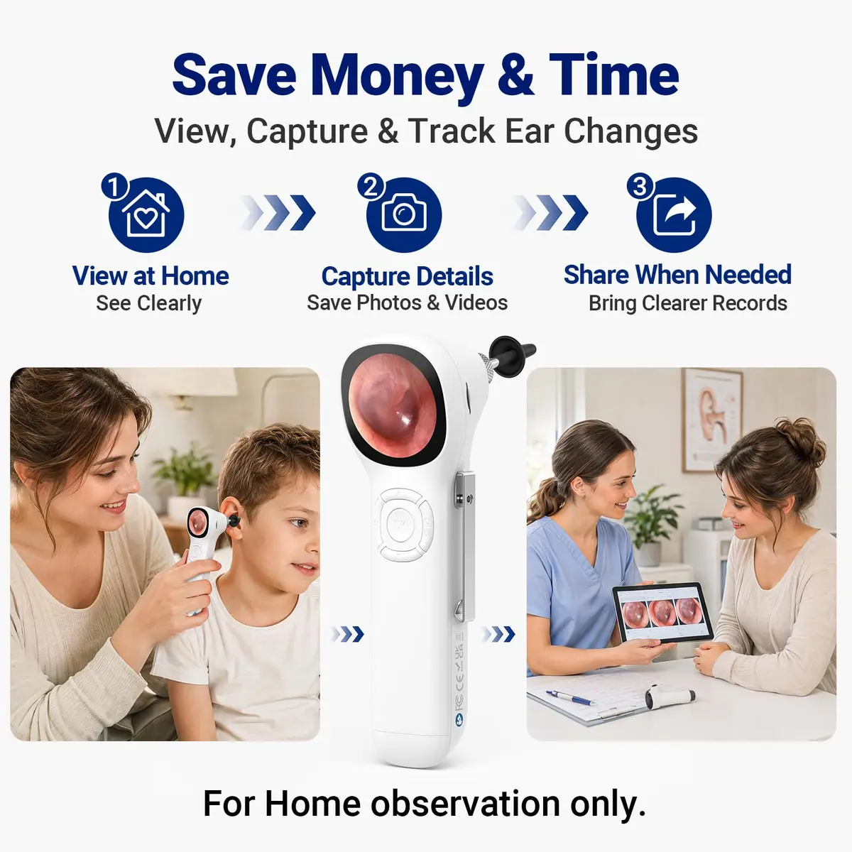 ScopeAround Otoscope with Light | HD Screen, No App Needed, Family Ear Camera - view 6