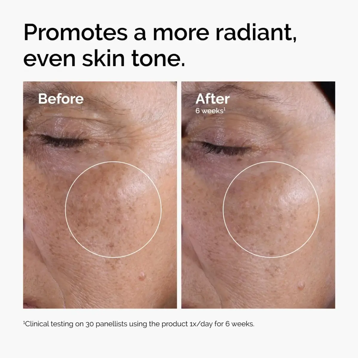 The Ordinary Glycolic Acid 7% Exfoliating Toner 200ml (6.8 Fl Oz) | Smoothes Skin Texture & Evens Tone - view 2