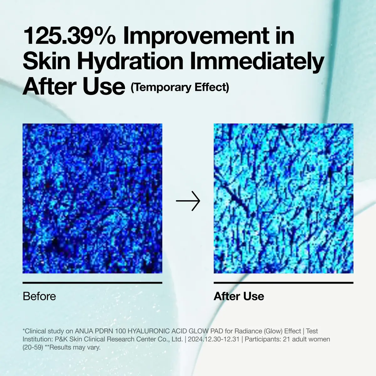 ANUA PDRN 100 Hyaluronic Acid Toner Pad, 6.1 fl oz (180 ml), 60 Count | Hydrating & Radiance Boosting - view 6