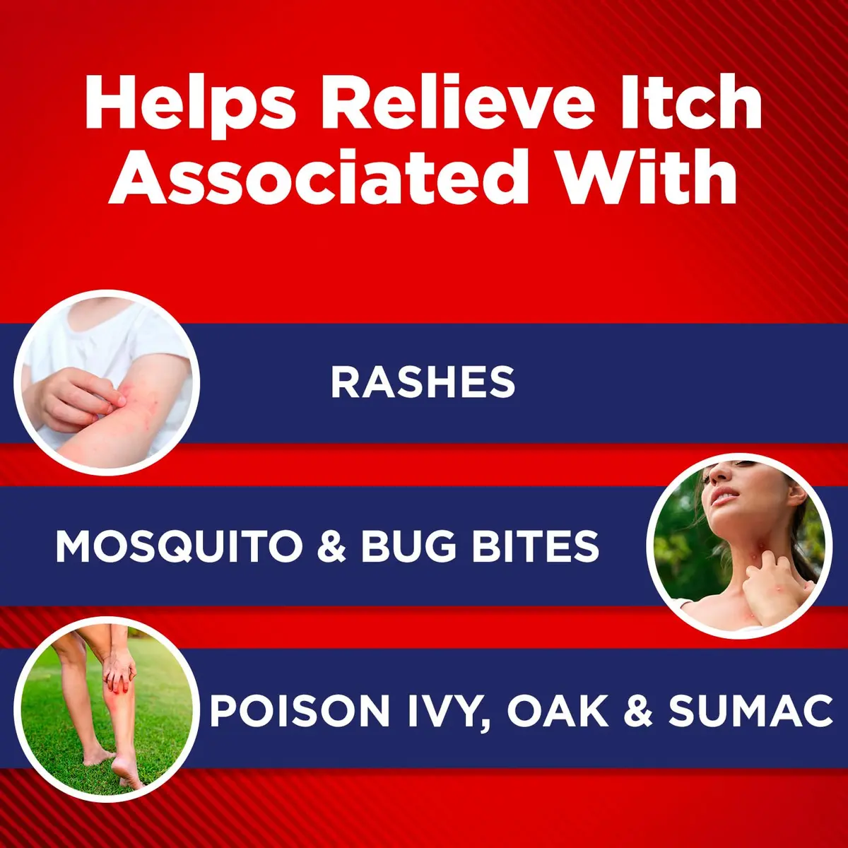 Cortizone 10 Max Strength Itch Relief Spray 2.7 oz | Soothing Aloe Formula for Minor Skin Irritations - view 5
