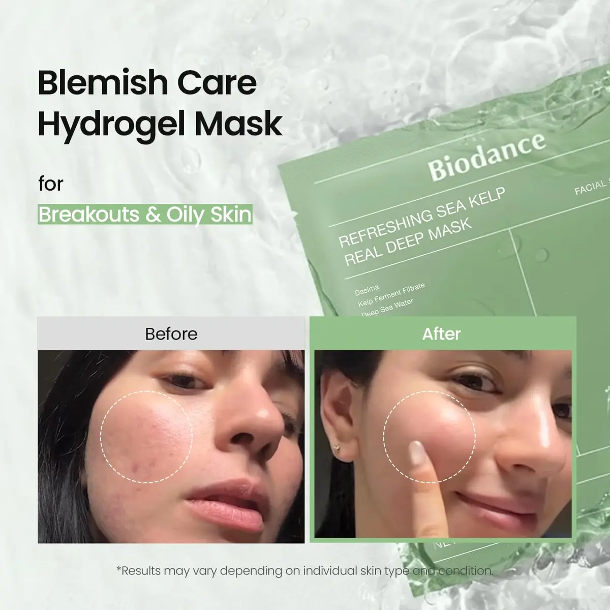BIODANCE Deep Hydrogel Face Mask with Sea Kelp for All Skin Types, 4 Pack | Calming, Oil & Sebum Control, Sunburn Relief - view 3