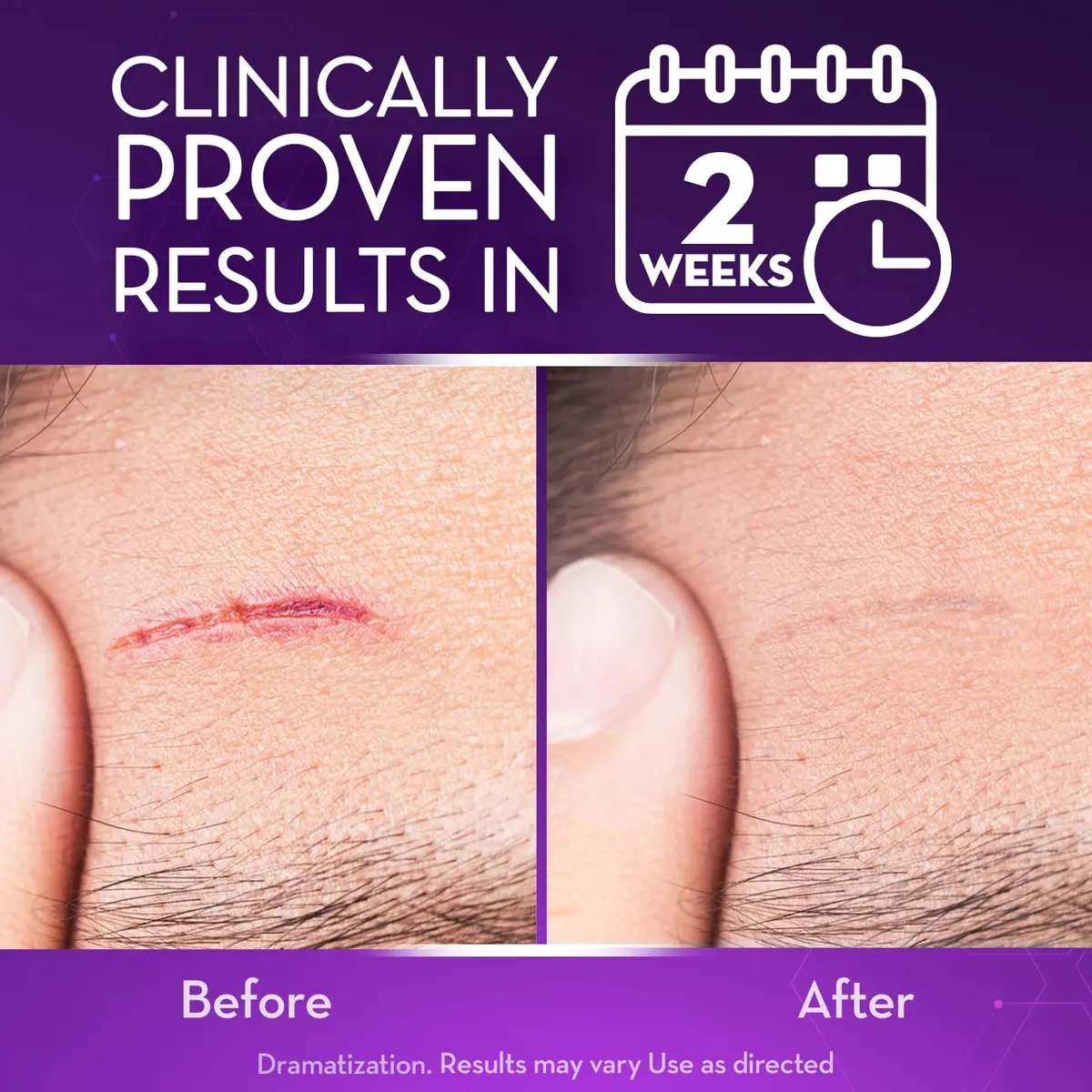 Cicatricure Advanced Scar Gel 2 oz | Proven Results in 2 Weeks for Face & Body - view 3