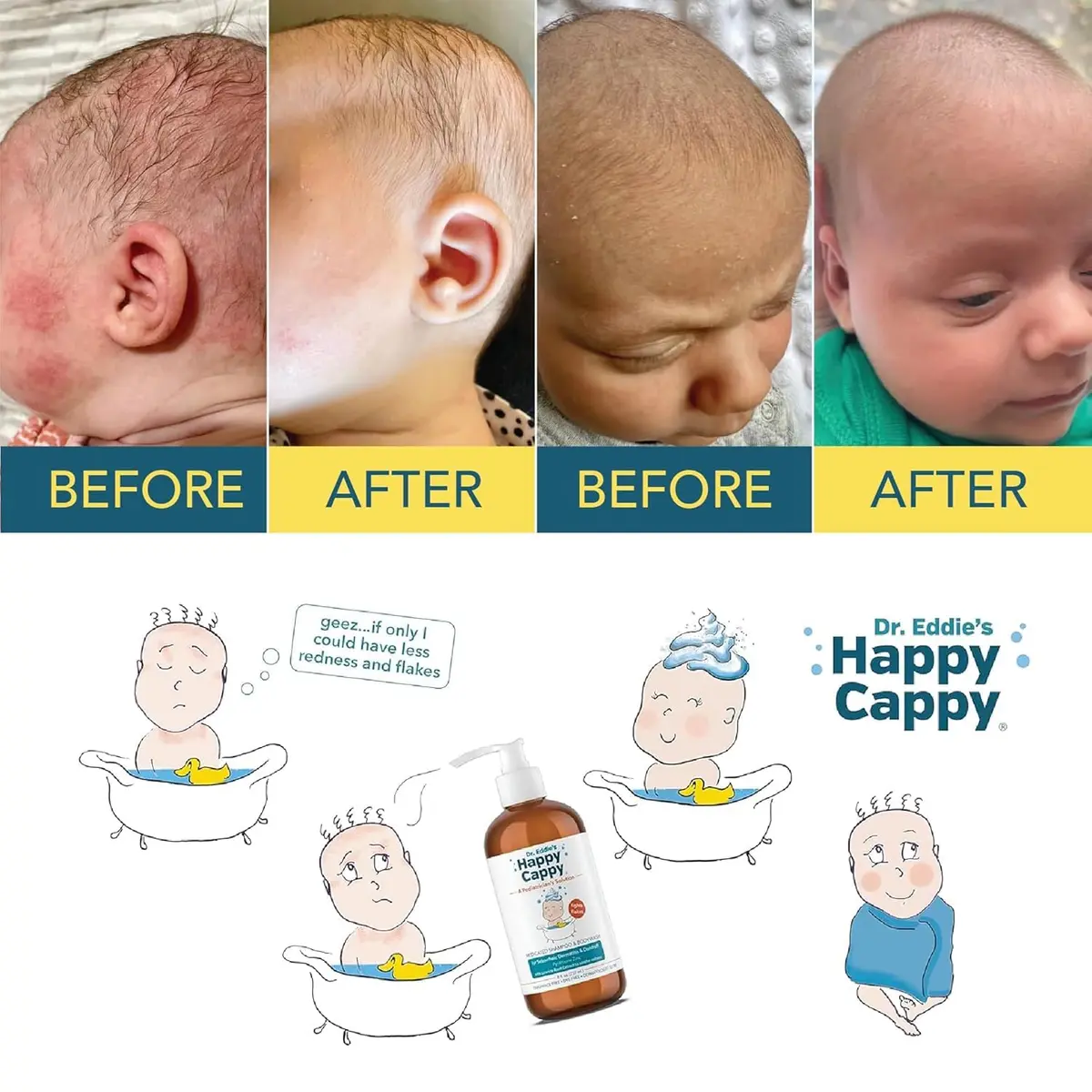 Happy Cappy Medicated Shampoo and Body Wash with Comb, 237ml (8 fl oz) | Dermatologist Tested for Baby Dandruff - view 6