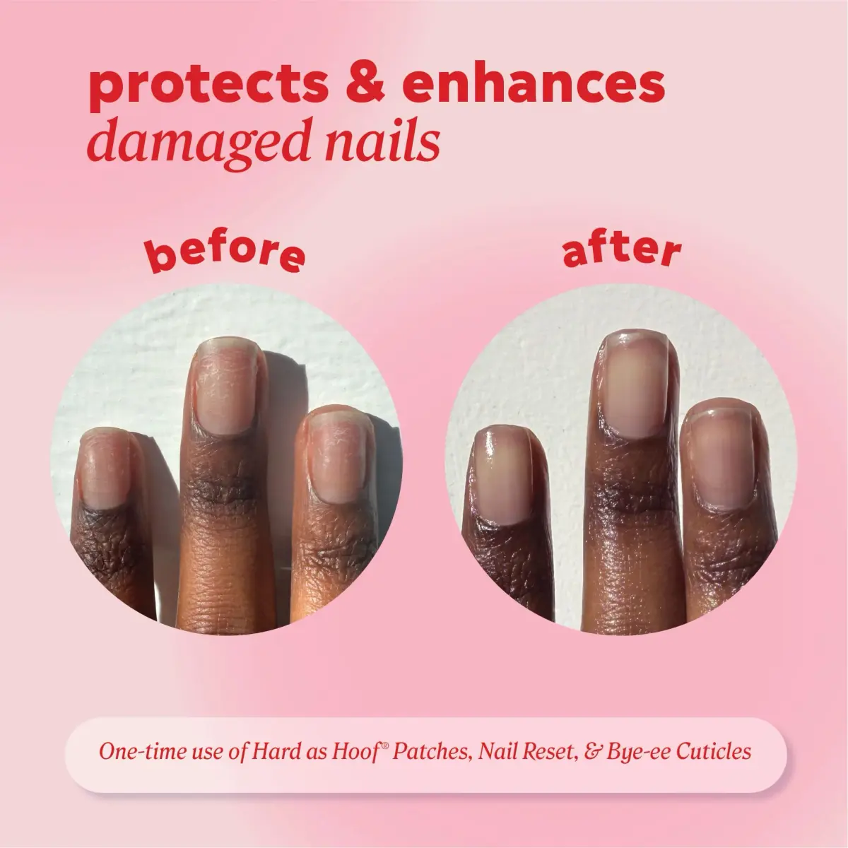 Onyx Professional Hard as Hoof Nail Repair Patches 20 Count | Overnight Nail & Cuticle Strengthening Treatment - view 4