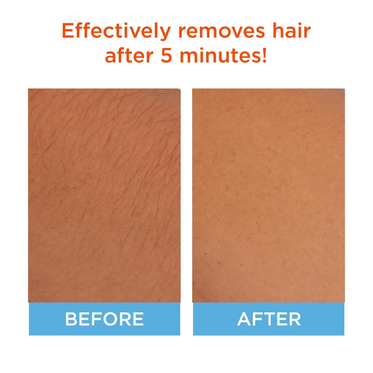 Sally Hansen Cream Hair Remover for Face 50ml (1.7 Fl Oz) | Vegan Formula for Smooth Skin - view 2