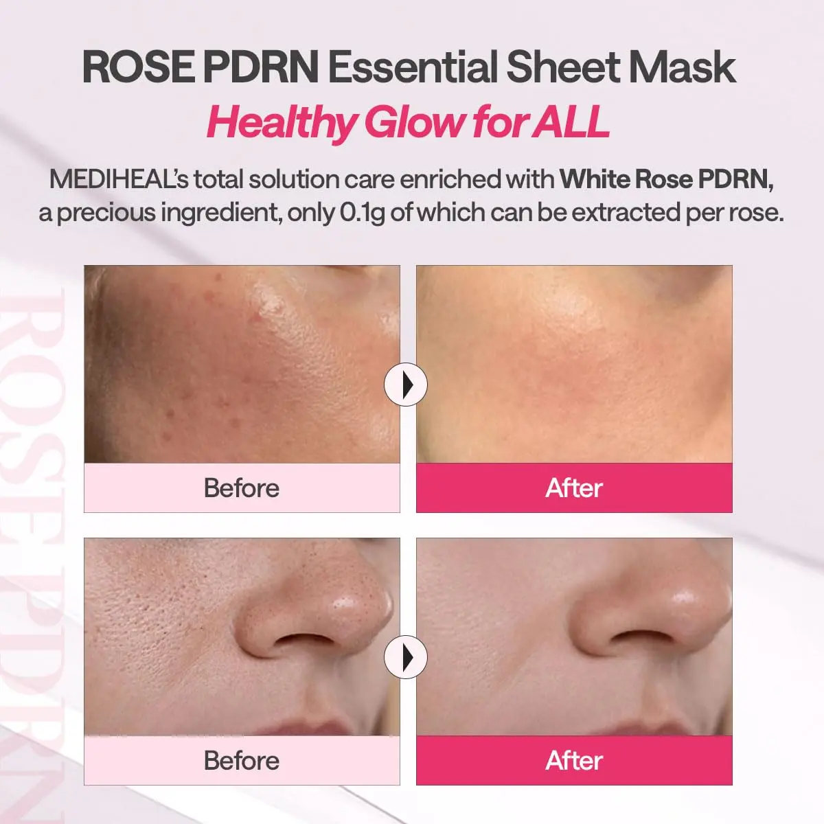 MEDIHEAL Rose PDRN Essential Face Sheet Mask 10ea | Korean Skincare for Healthy Glow - view 5