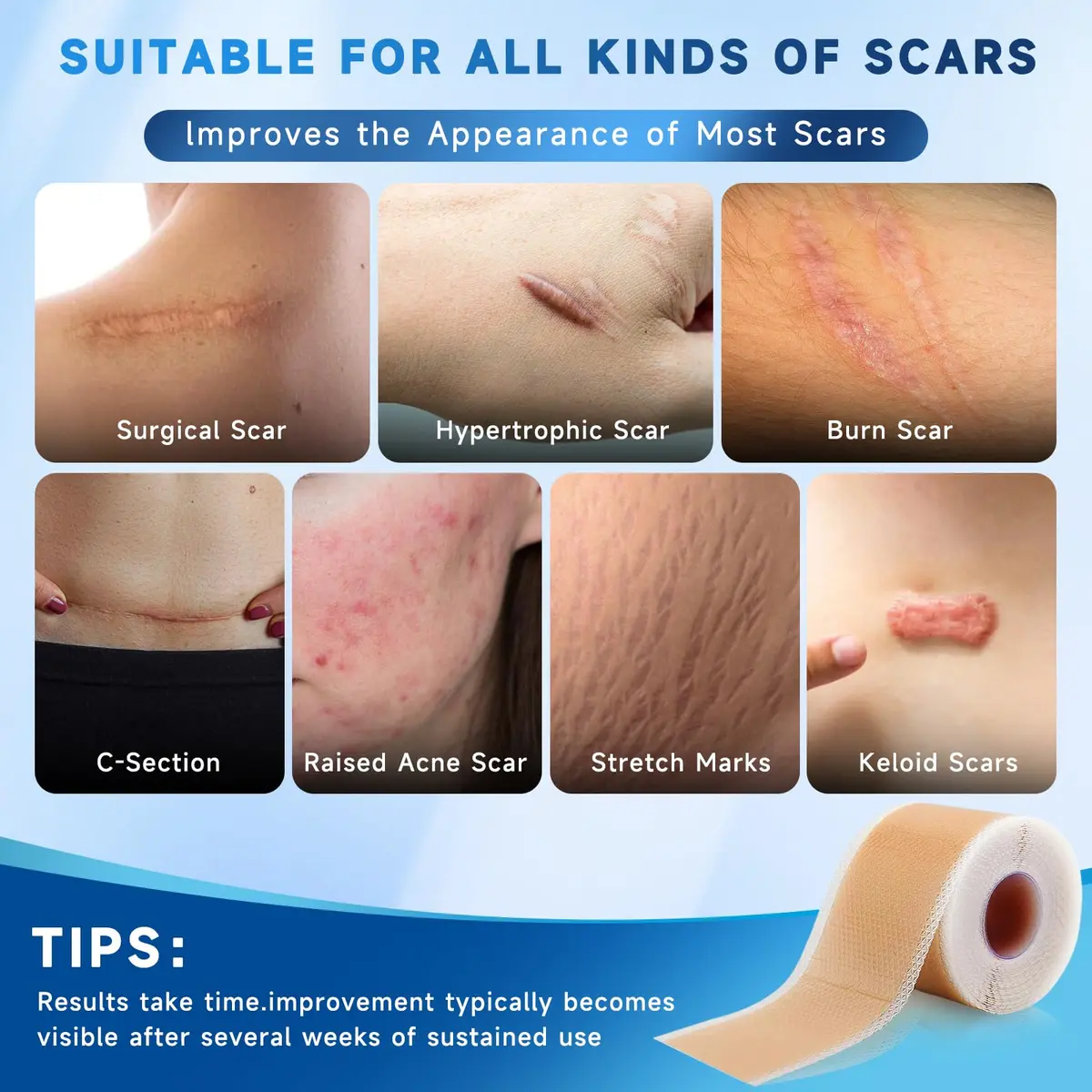 Rvlaim Silicone Scar Sheets for Surgical & Burn Scars, 3M, 1.6” x 120” Roll | Medical-Grade, Reusable & Hypoallergenic - view 3