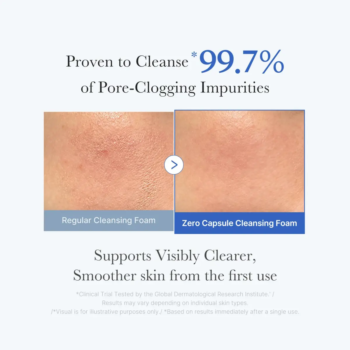 medicube Zero Pore Capsule Cleansing Foam AHA BHA PHA 120g (4.23 oz) | Deep Cleansing for Texture & Pore Care - view 3