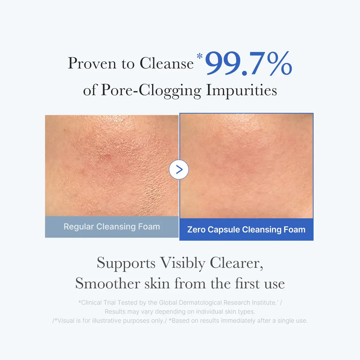 Medicube Zero Pore SA Clear Capsule Cleansing Foam 125ml (4.23 Fl Oz) | Deep Pore Cleansing for Blackheads & Pores - view 3