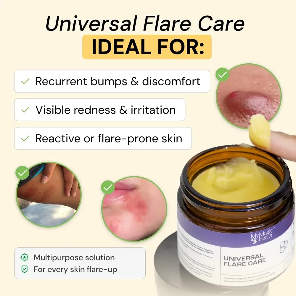 MyMagicHealer Universal Flare Care Drawing Salve 59 ml (2 oz) | Calms Skin Flare-Ups & Irritated Skin - view 2