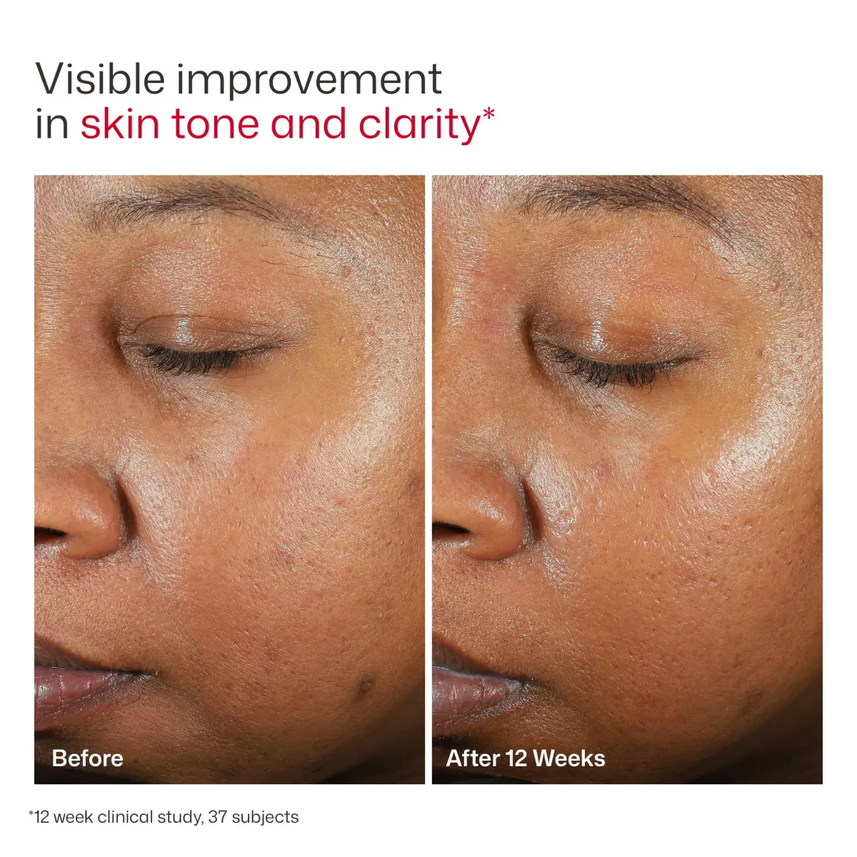 EltaMD UV Clear Untinted Face Sunscreen SPF 46 110ml (3.7 Fl Oz) | Dermatologist Recommended for Sensitive Skin - view 9