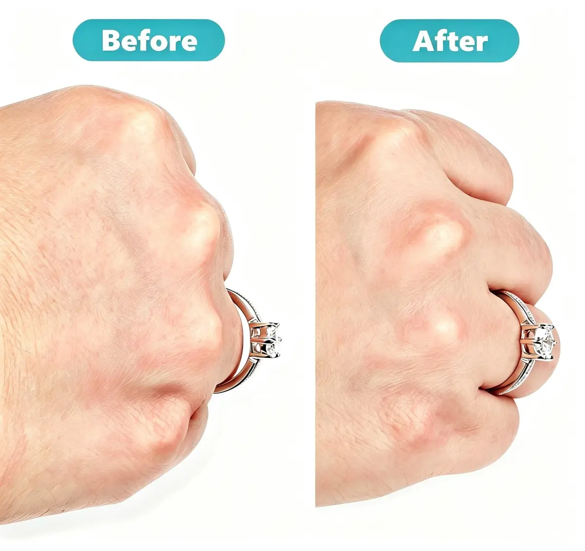Feramox Invisible Ring Size Adjuster Set | 8 Sizes Fit 1mm-10mm Bands | Transparent TPU Material - view 5