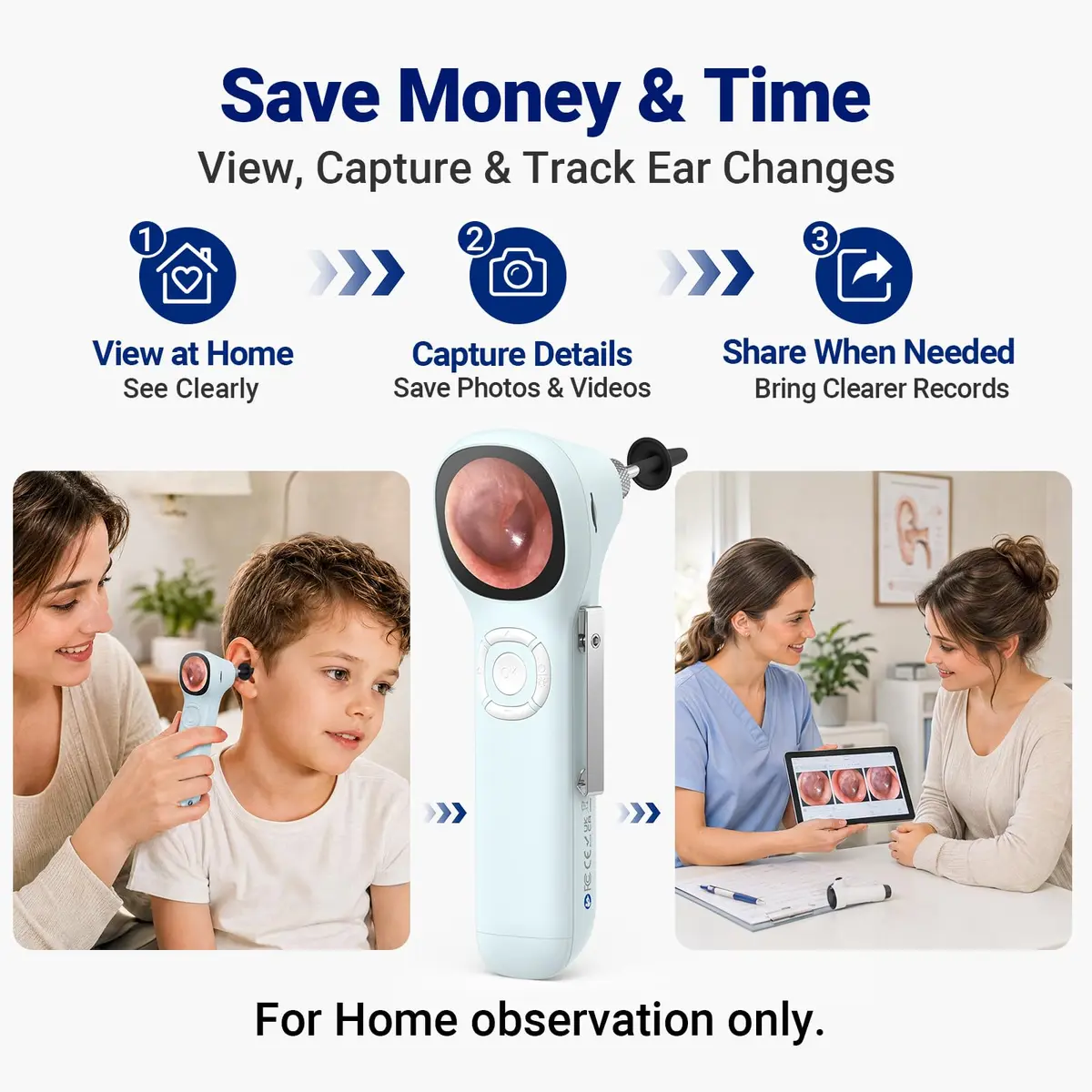 ScopeAround SA160 Otoscope with Light | HD Screen, No App Needed, Family Use - view 6