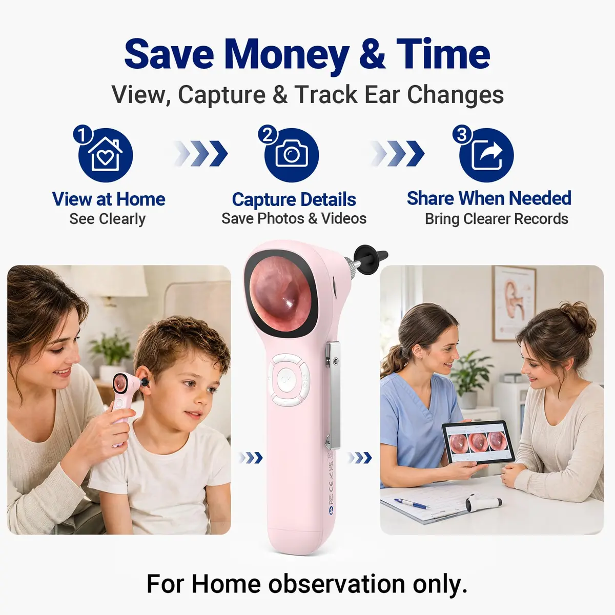 ScopeAround Otoscope with Light No App Needed HD Screen Family Use - view 6