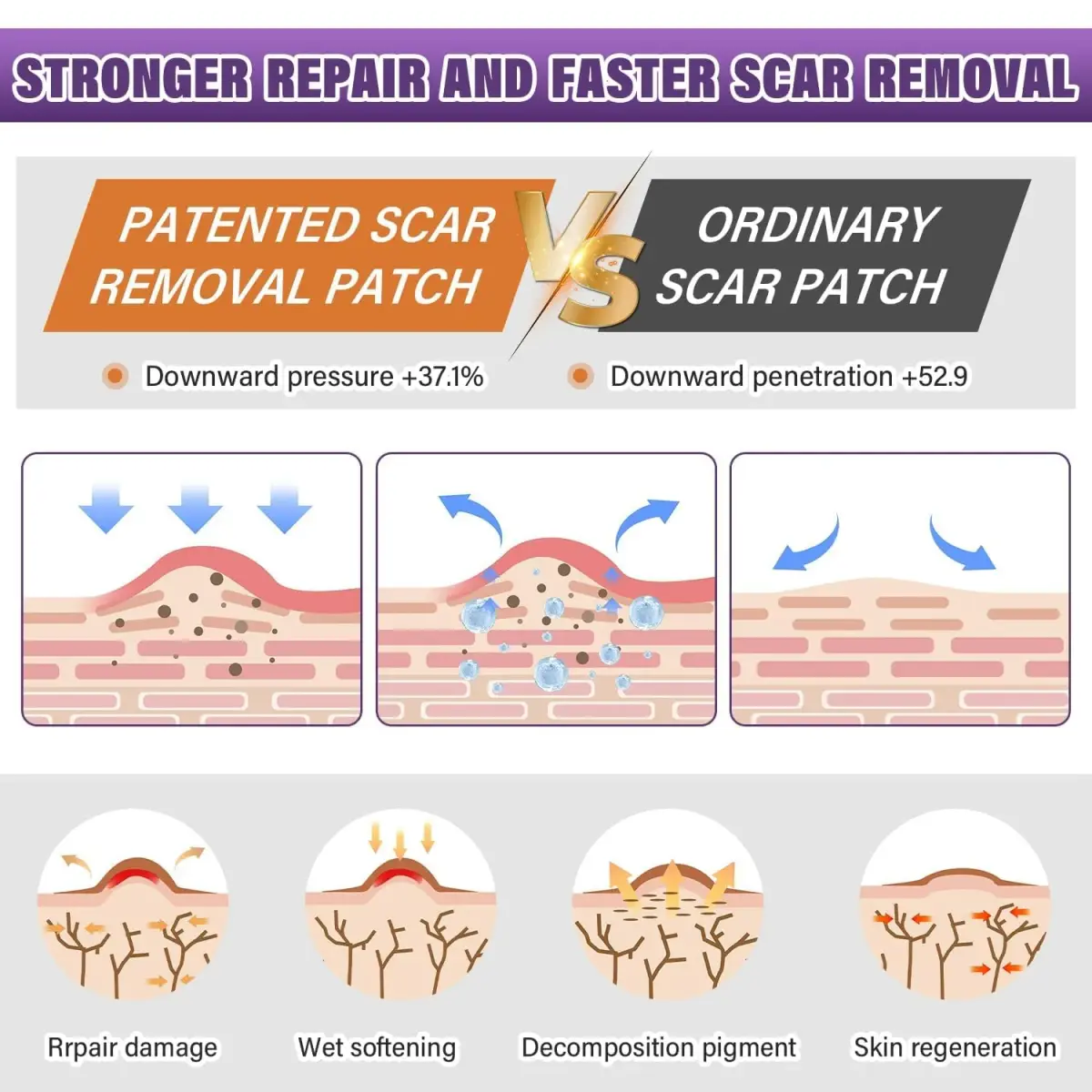 PSECICI Silicone Scar Sheets Medical Grade Scar Tape 4M (157" x 1.6") | Advanced Scar Treatment for All Scar Types - view 3