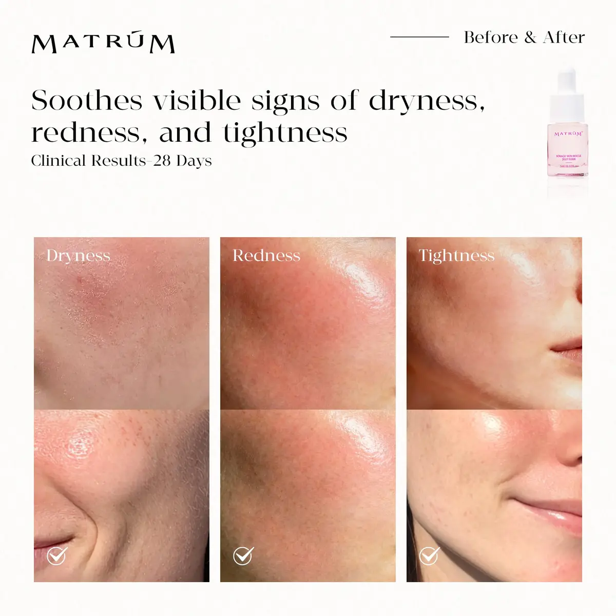 MATRÚM Mini Face Serum Duo | Travel Skincare Sets for All Skin Types with Soothing & Brightening (70-120 chars) - view 5