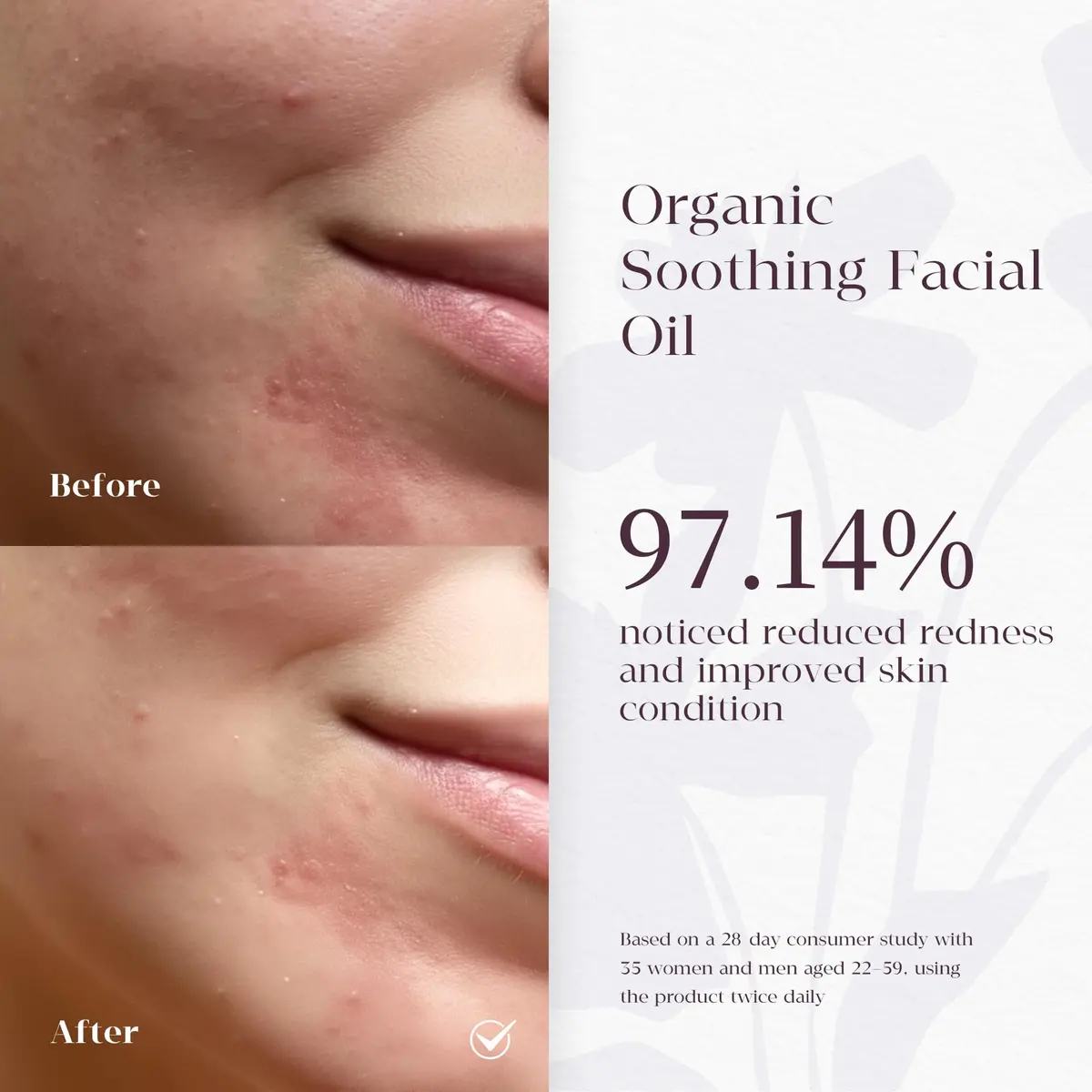 MATRÚM Organic Barrier Repair Face Serum – Brightening, Firming & Hydrating Serum for Dry & Sensitive Skin, Soothes Redness & Dryness, with Niacinamide, Vitamin E & Camelina Seed Oil - view 5