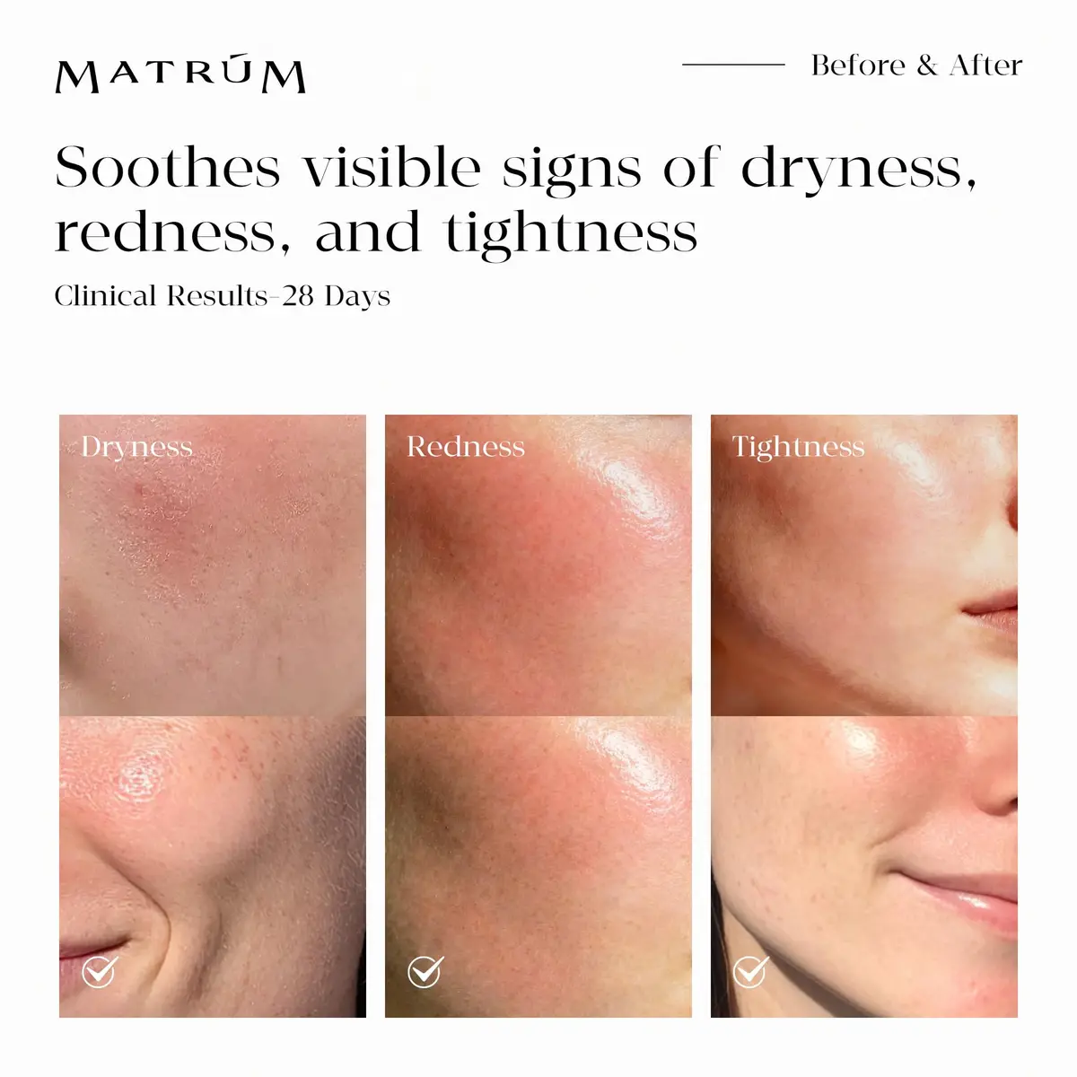 MATRÚM Mini Discovery & Travel Size Set - 4 x Mini Face Oil for Deep Repair & Radiance Boost & Firming - view 8
