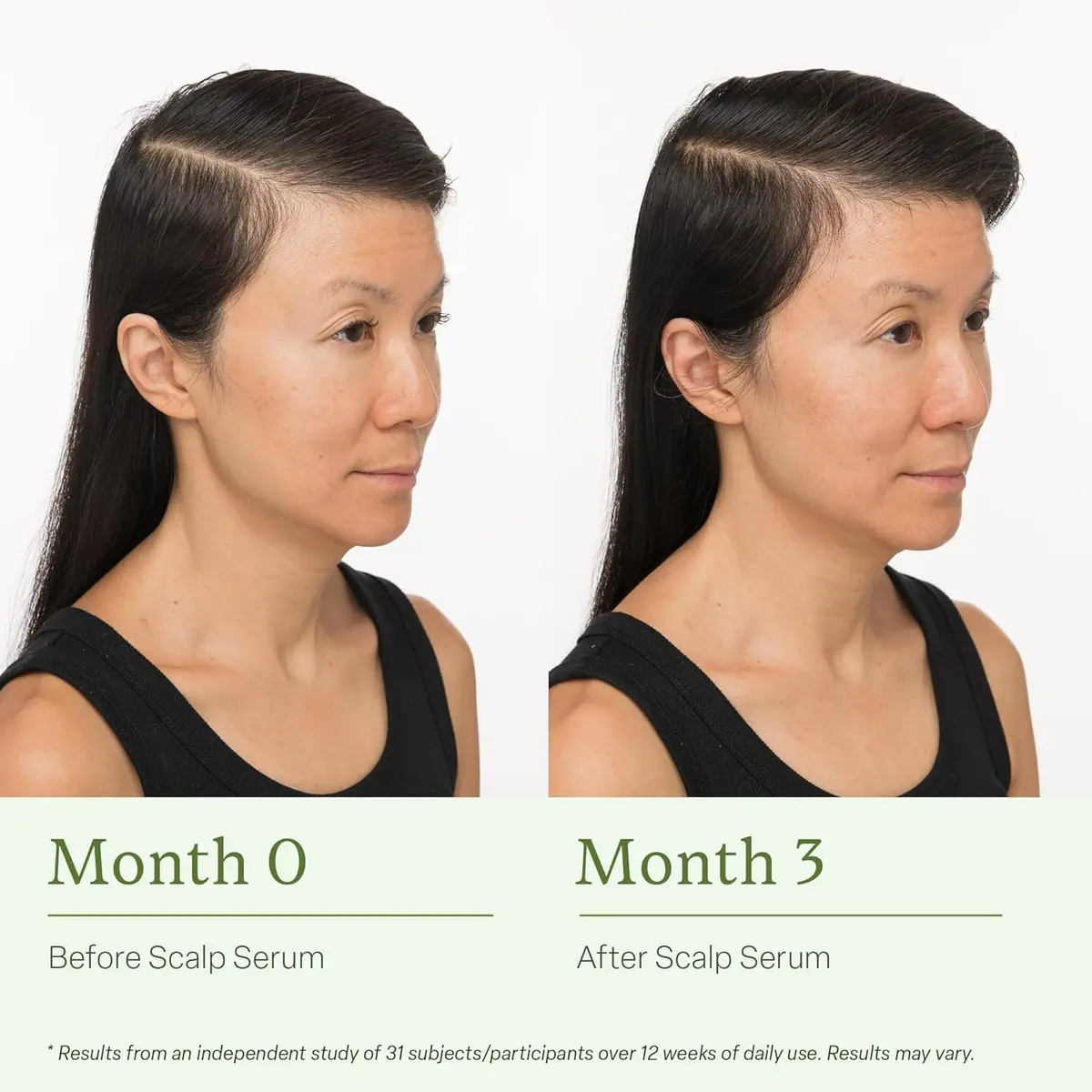 Divi Scalp Serum for Thinning Hair 30ml | Clinically Tested Nourishing Formula with Amino Acids & Rosemary Oil - view 5
