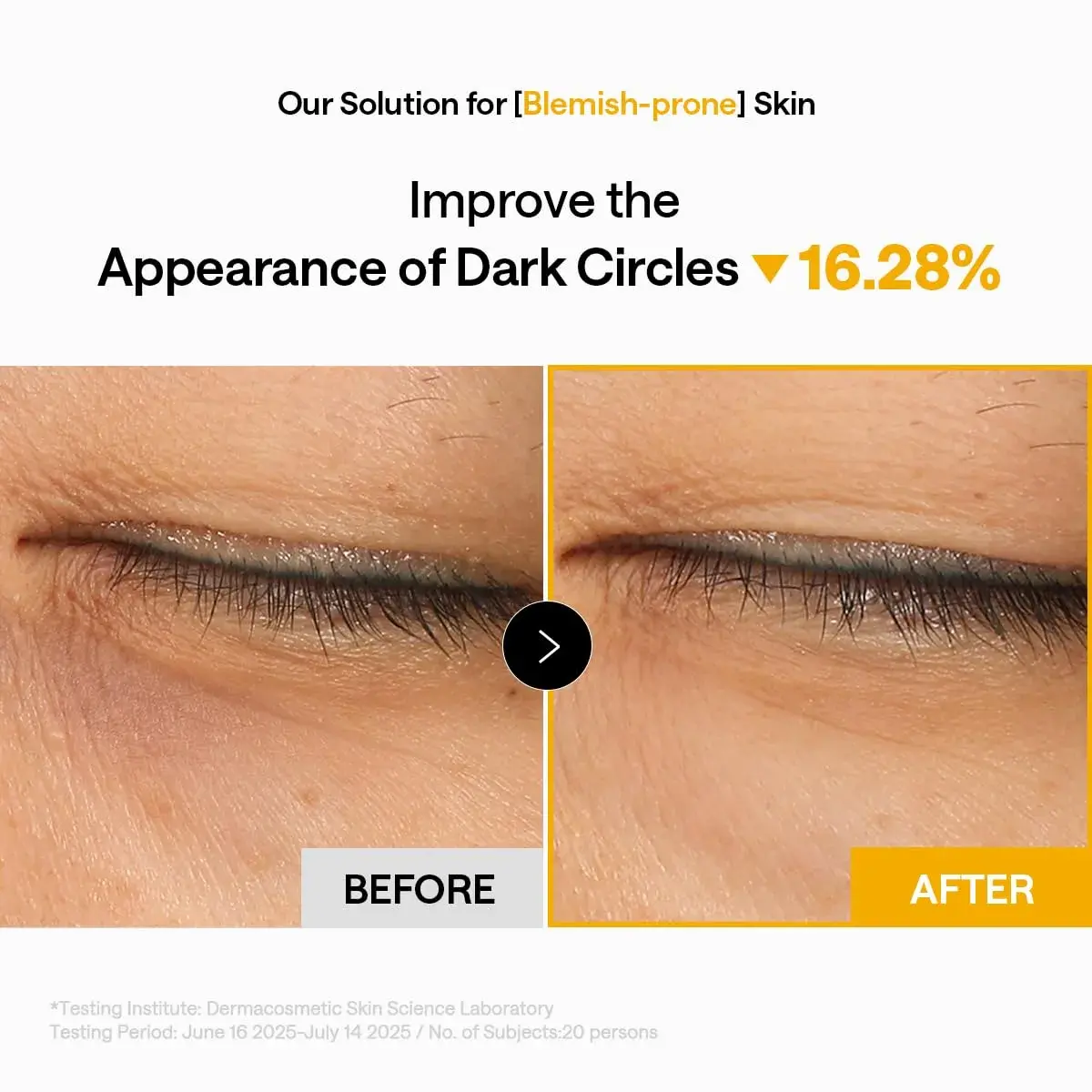MEDIHEAL Vitamin C Collagen Capsule Eye Patches 60 Count | Brightening & Firming Hydrogel Pads for Dark Circles & Fine Lines - view 6