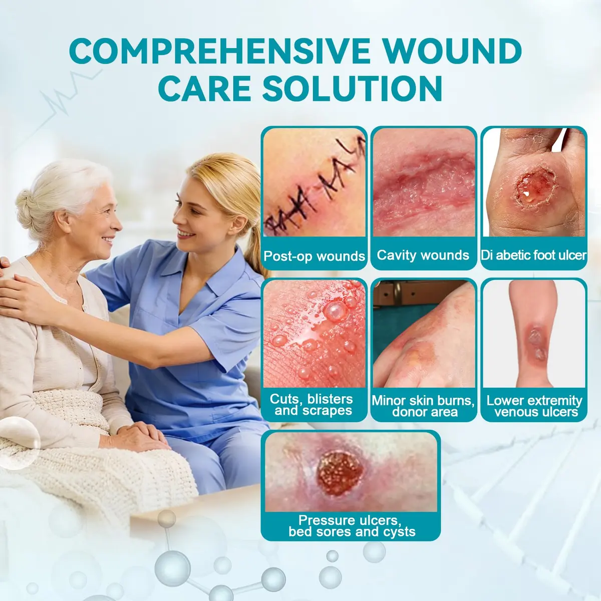 Dimora Calcium Alginate Wound Dressing 4'' x 4'' | Heavy Absorbent, Non-Stick, Sterile Gauze for Moderate to Heavy Exudate Wounds - view 2
