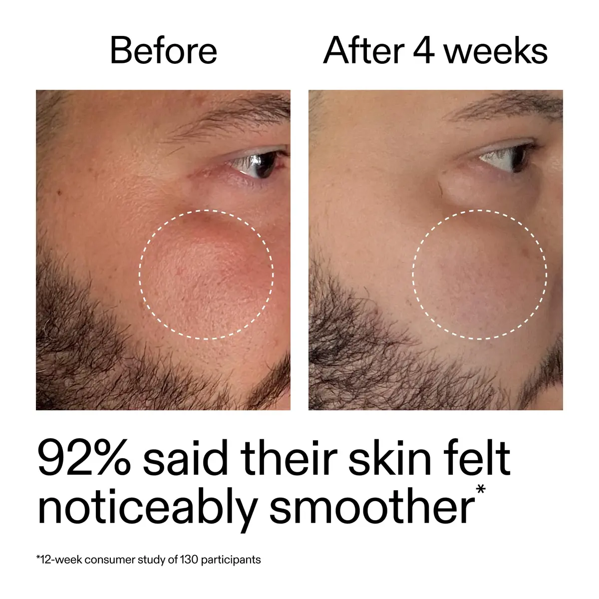 The INKEY List Starter Dual Retinol Serum 1 fl oz | Visibly Smooth Fine Lines in 7 Days - view 8