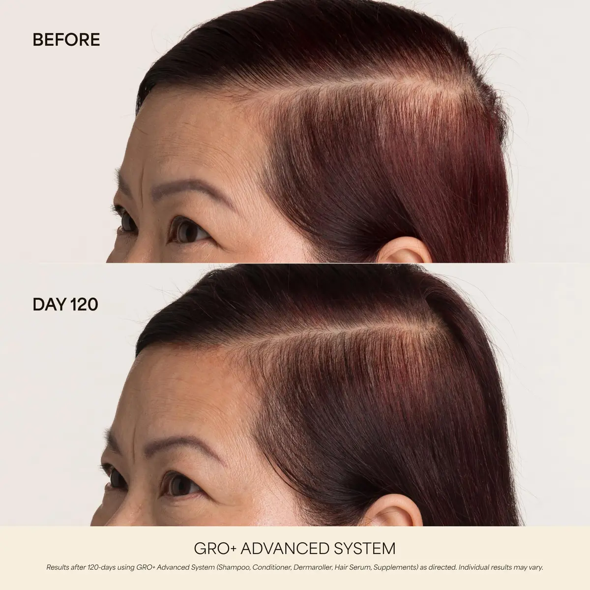 VEGAMOUR GRO+ Advanced Hair Growth Supplements - Boosts Hair Growth & Density - 30 Pill Packs/Box (Pack of 2) | Supports Thicker Hair - view 3