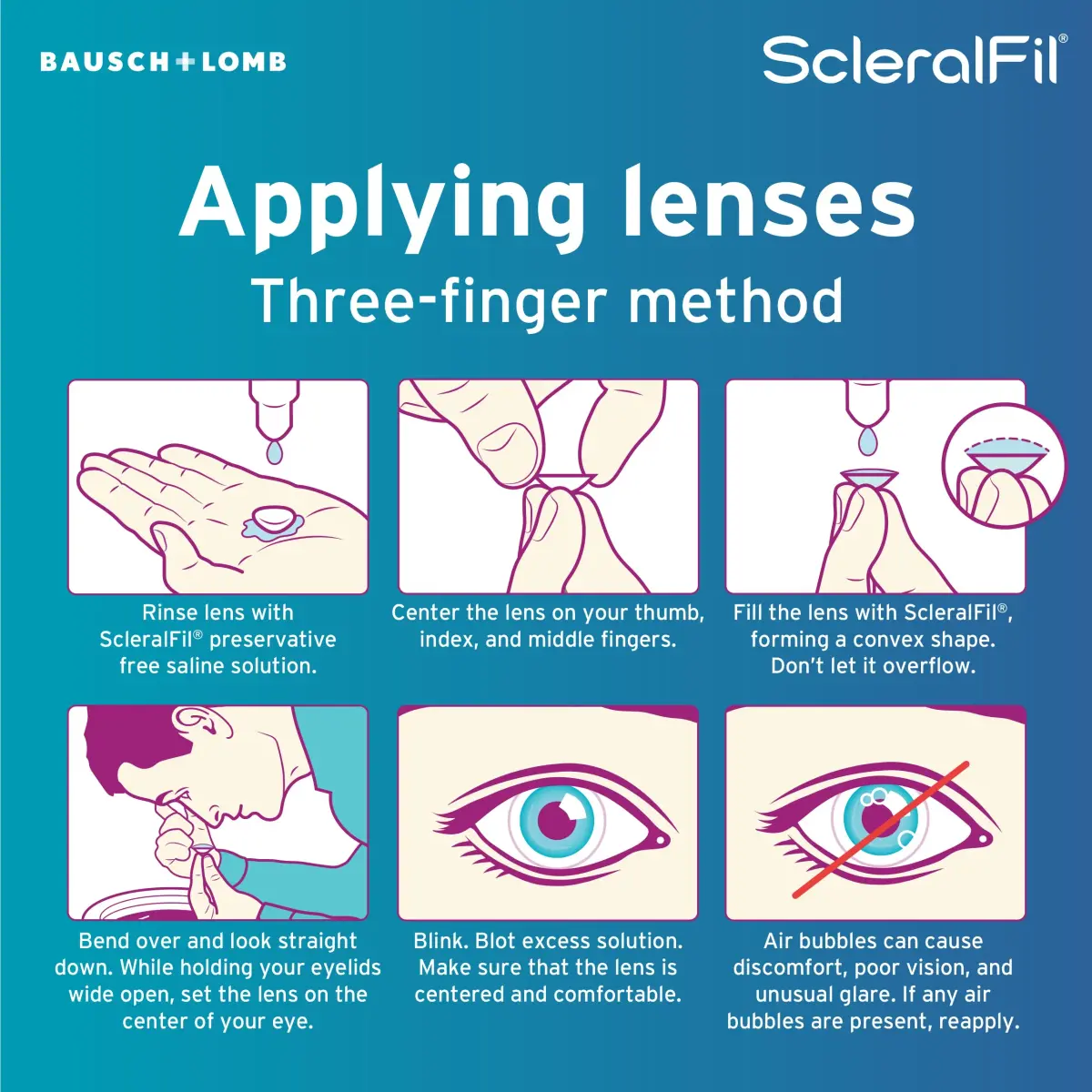 Bausch + Lomb ScleralFil Preservative-Free Saline Solution 60 x 10ml Vials | Buffered Isotonic for Scleral Lenses - view 6