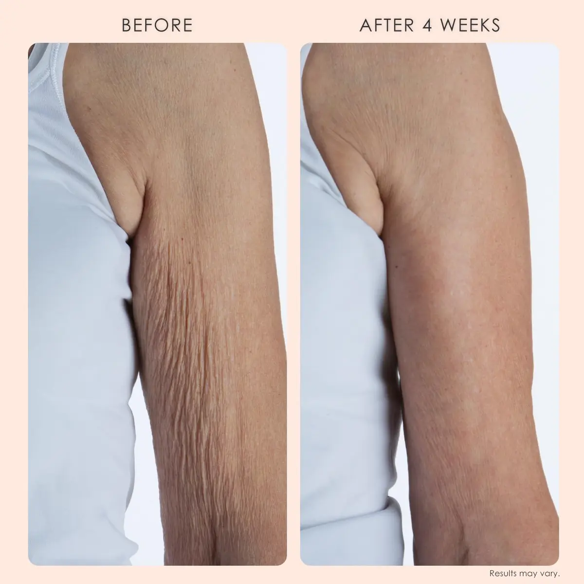 Crepe Erase Body Firm Crepe Erase Body Repair Treatment 10 oz | Anti-Aging Firming Lotion with Collagen Peptides - view 3