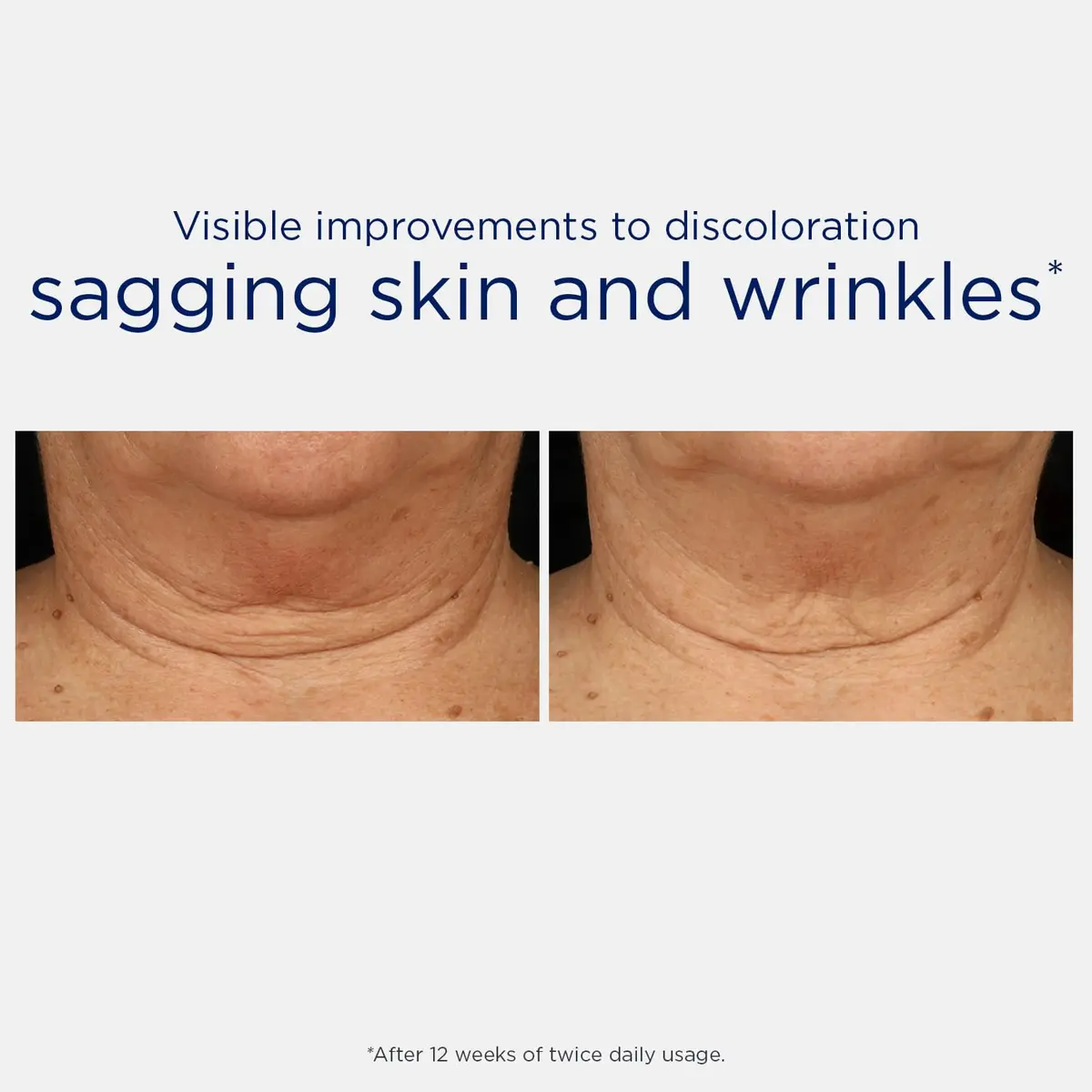 NEOSTRATA Triple Firming Neck Cream 80 g | MicroDiPeptide229® & NeoGlucosamine for Skin Firming - view 5