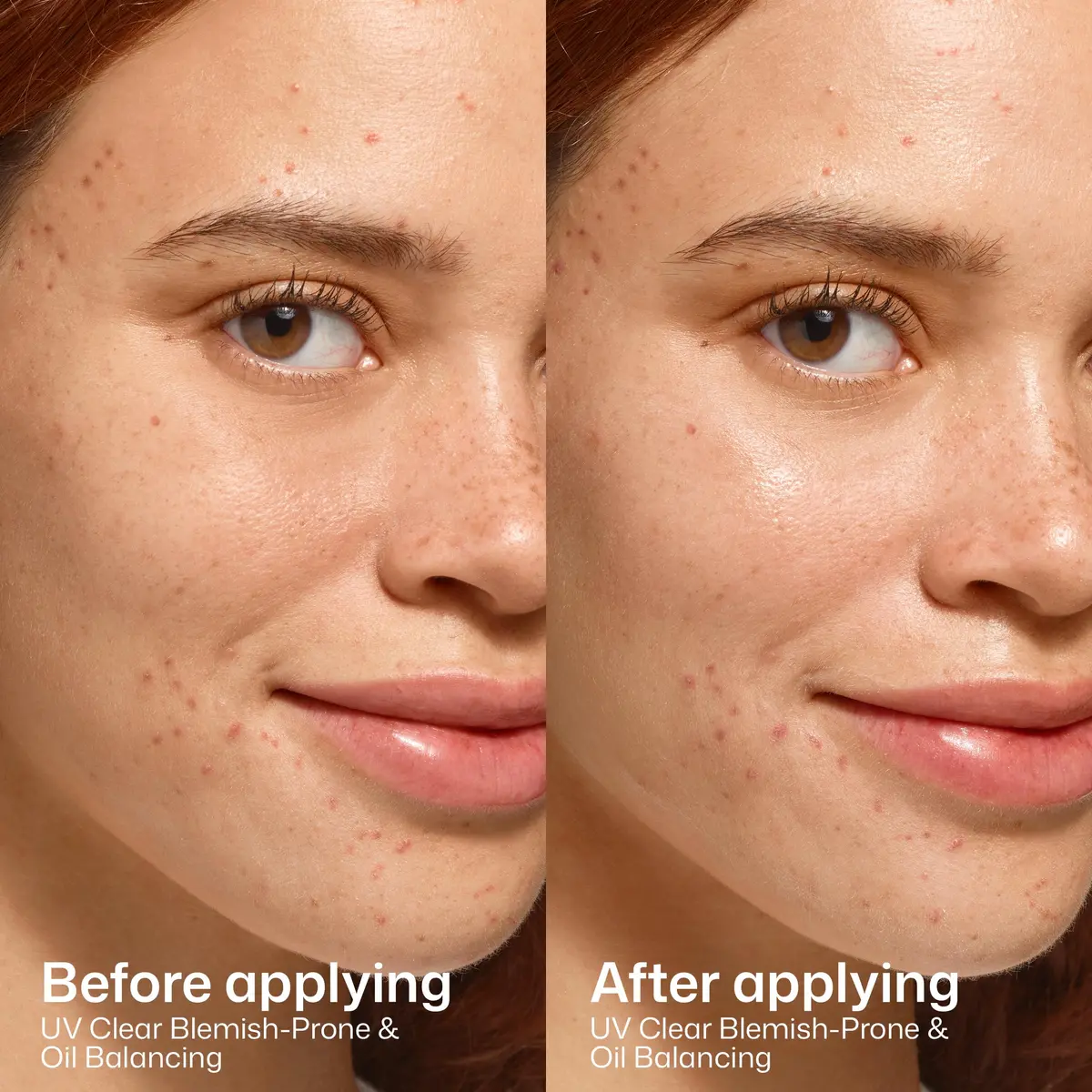 EltaMD UV Clear Blemish-Prone and Oil Balancing SPF 50 Face Sunscreen 50ml (1.7 oz) | Broad Spectrum Protection - view 5