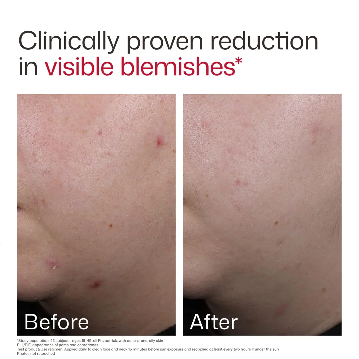 EltaMD UV Clear Blemish-Prone and Oil Balancing SPF 50 Face Sunscreen 50ml (1.7 oz) | Broad Spectrum Protection - view 6