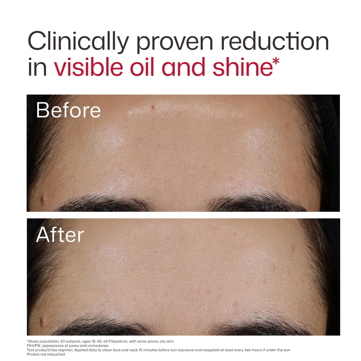 EltaMD UV Clear Blemish-Prone and Oil Balancing SPF 50 Face Sunscreen 50ml (1.7 oz) | Broad Spectrum Protection - view 7