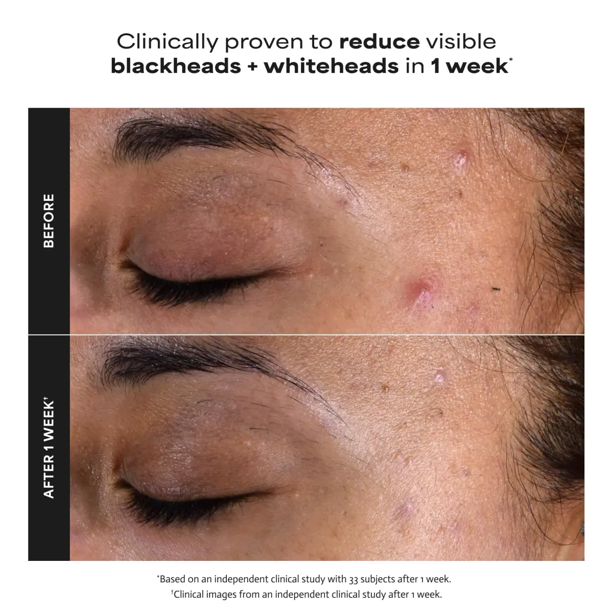 Paula's Choice SKIN PERFECTING 2% BHA Liquid Salicylic Acid Exfoliant 236ml (8 Fl Oz) | Gentle Non-Abrasive Leave-On Exfoliant - view 3
