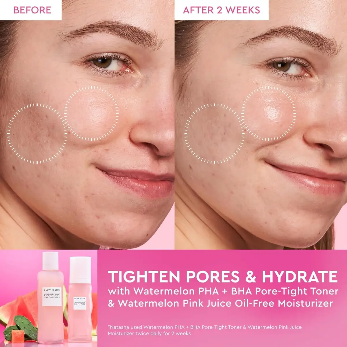 Glow Recipe Watermelon Glow PHA + BHA Pore-Tight Toner 150ml (5 Fl Oz) | Exfoliates & Hydrates for Poreless Skin - view 4