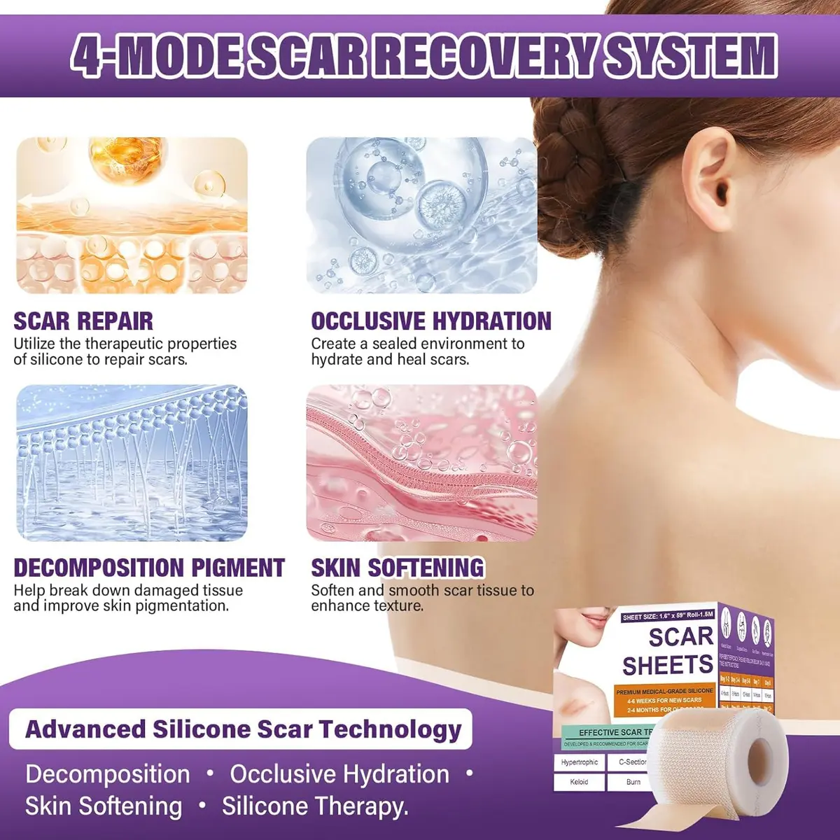 PSECICI Silicone Scar Sheets Medical Grade Tape for Old & New Scars 3M (1.6" x 120") | Advanced Scar Treatment - view 5