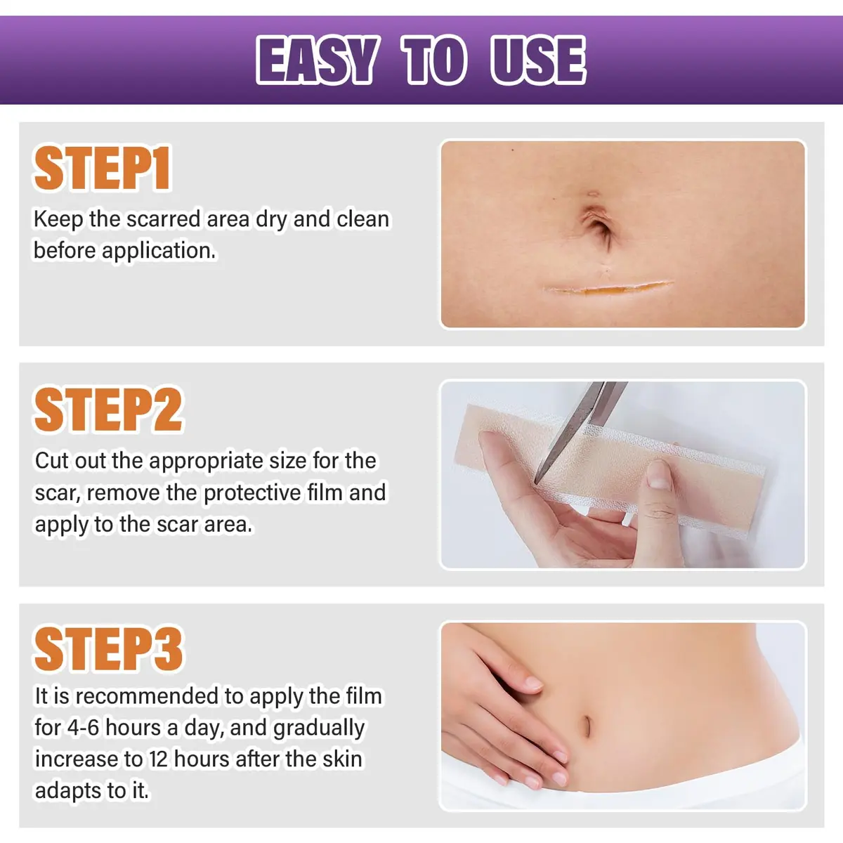 PSECICI Silicone Scar Sheets Medical Grade Tape for Old & New Scars 3M (1.6" x 120") | Advanced Scar Treatment - view 7
