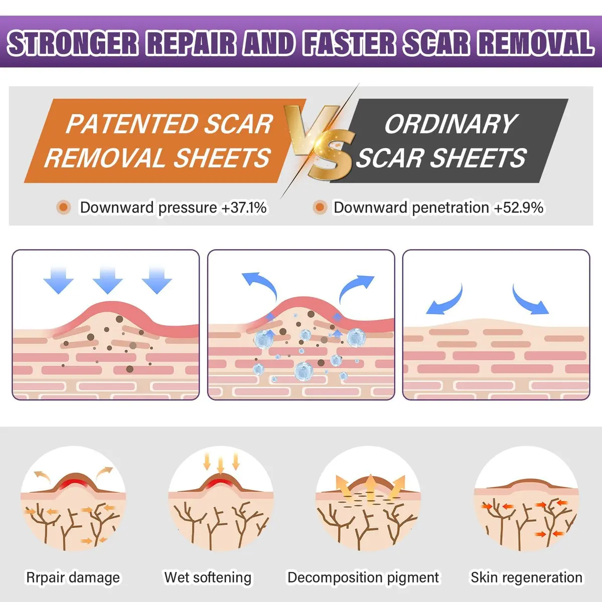 PSECICI Silicone Scar Sheets Medical Grade Tape for Old & New Scars 3M (1.6" x 120") | Advanced Scar Treatment - view 3