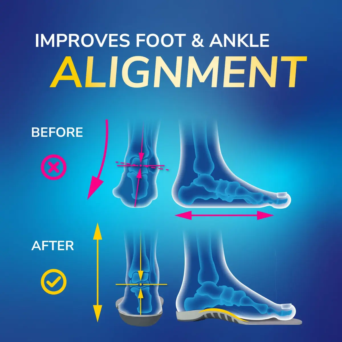 Dr. Scholl's Women's Size 6-10 Stabilizing Support Insoles | 12-Pack Gray - view 2